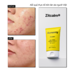 CALMING MOISTURIZER - Ảnh 5