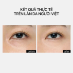 A RETINYL RETINOATE Phức hợp retinyl retinoate thế hệ mới - Ảnh 6
