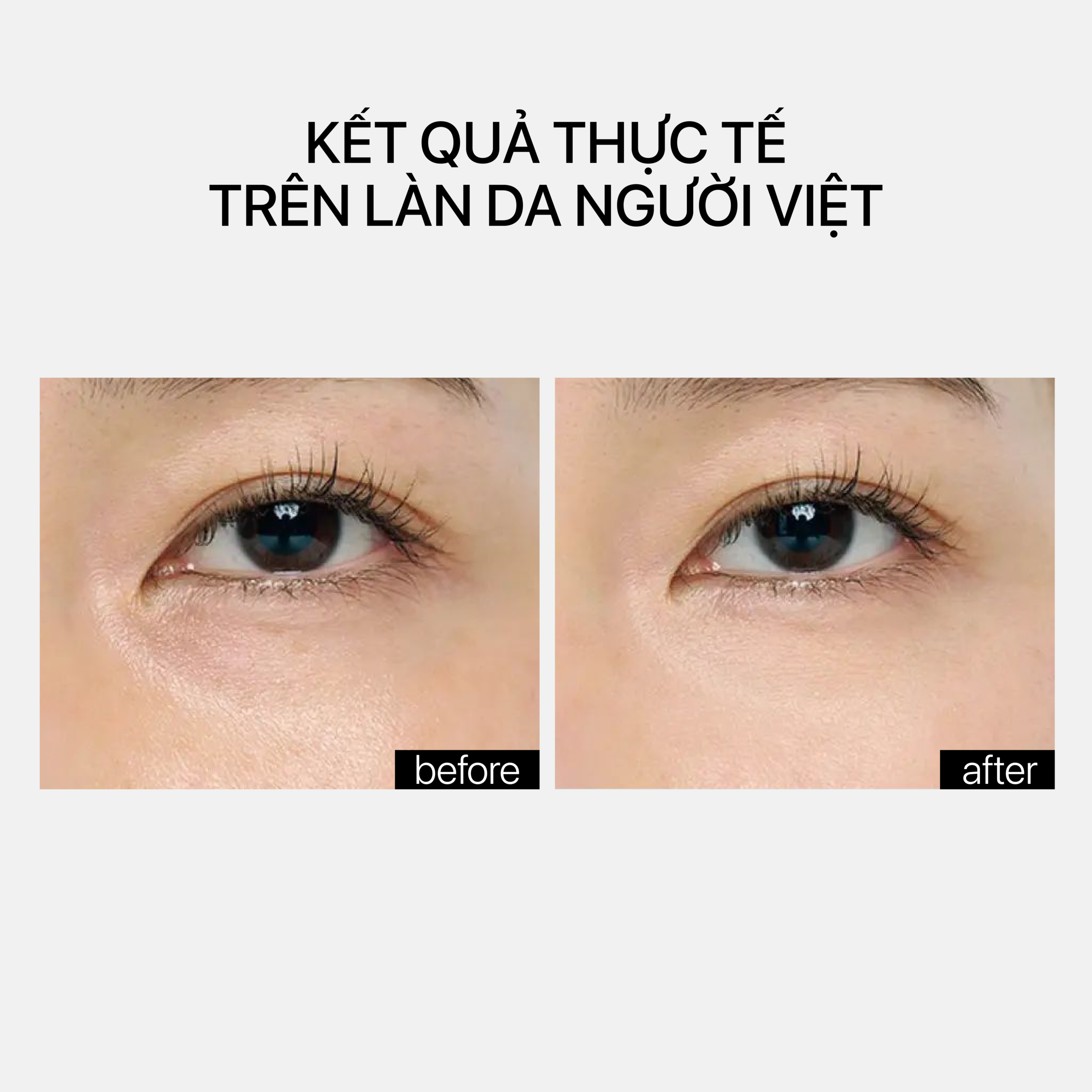 A RETINYL RETINOATE Phức hợp retinyl retinoate thế hệ mới - Ảnh 6