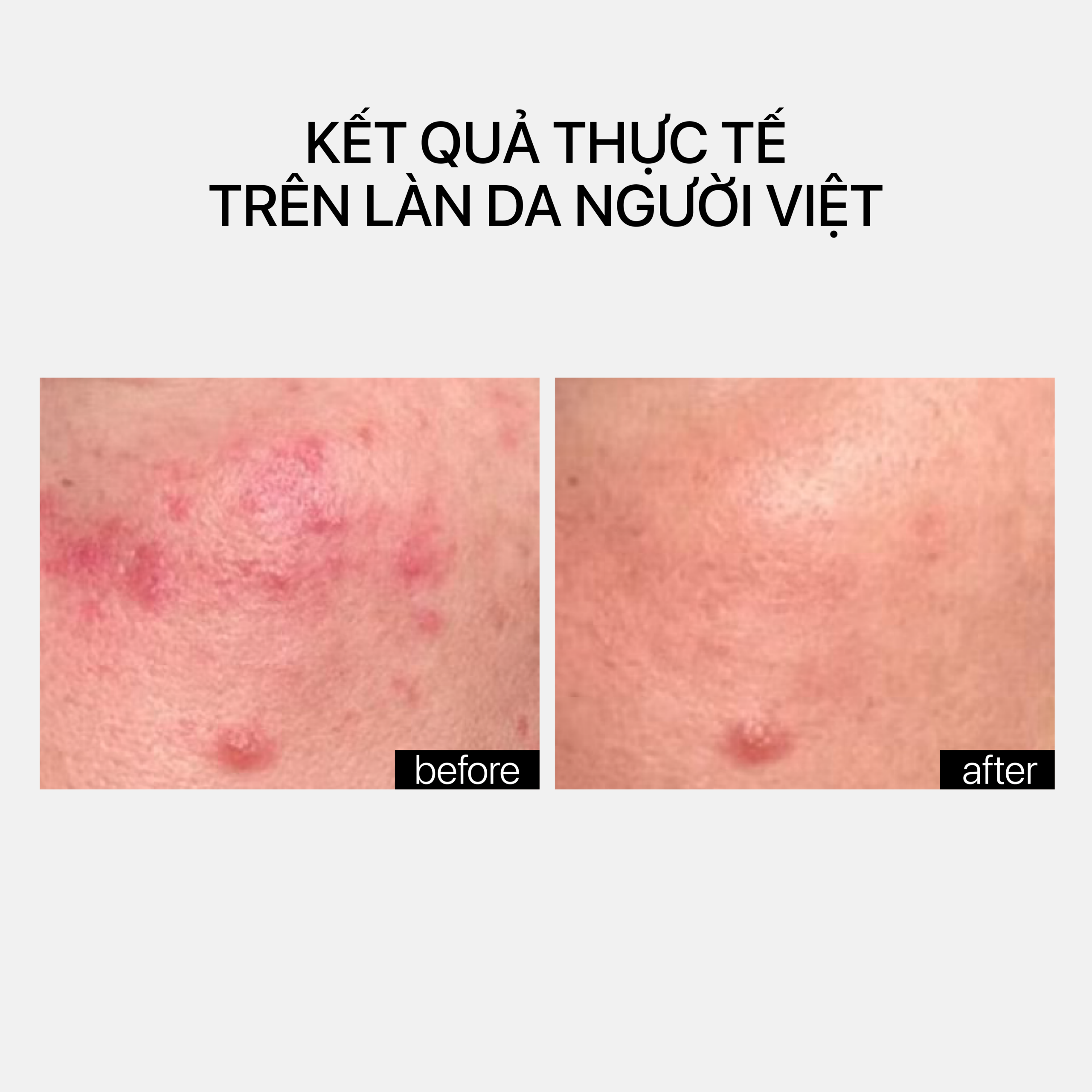 CERAMIDE TREATMENT Phức hợp ceramide phục hồi ngừa lão hóa da - Ảnh 6