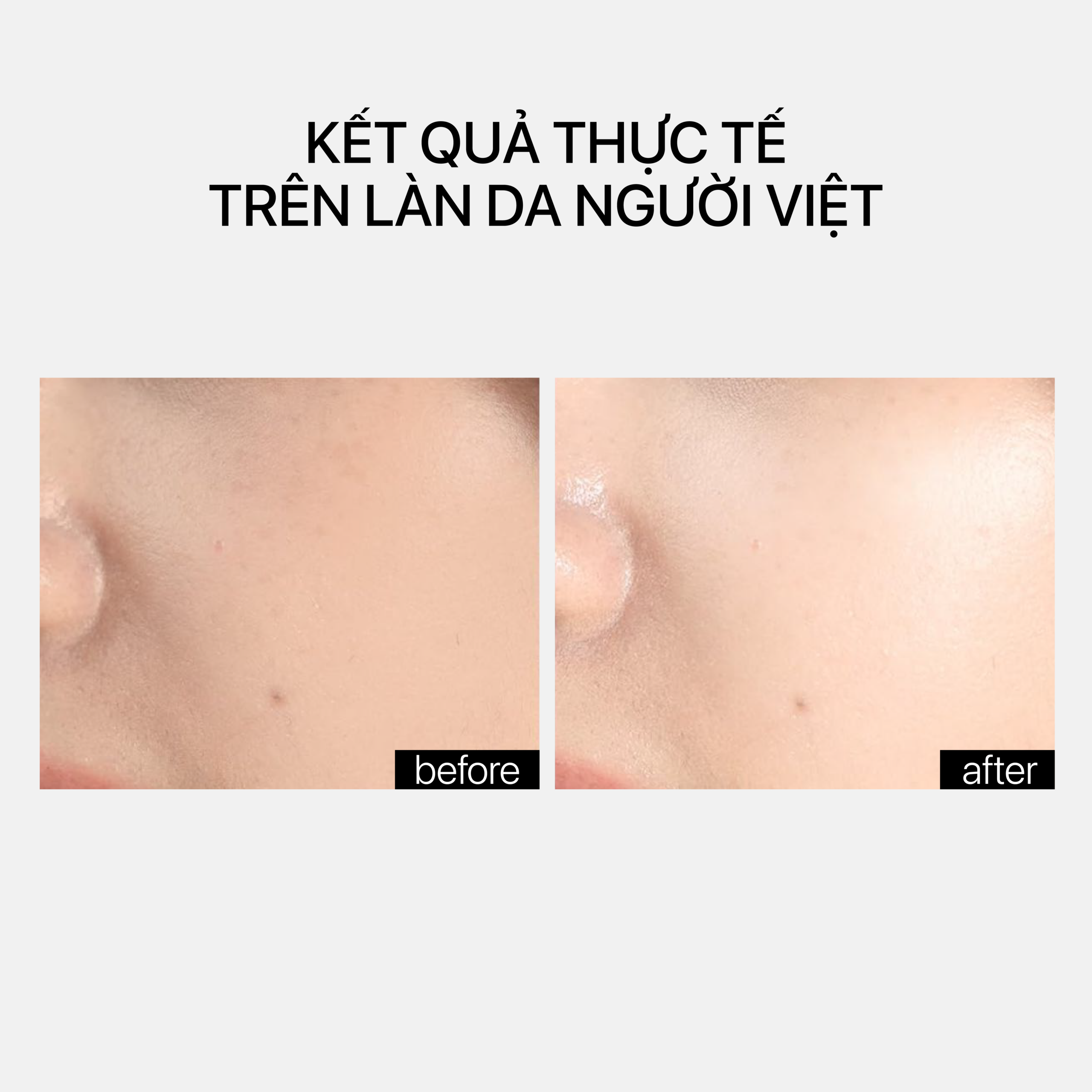 HAPCA FILLER - Ảnh 4