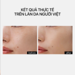 LINO-8 - Ảnh 4