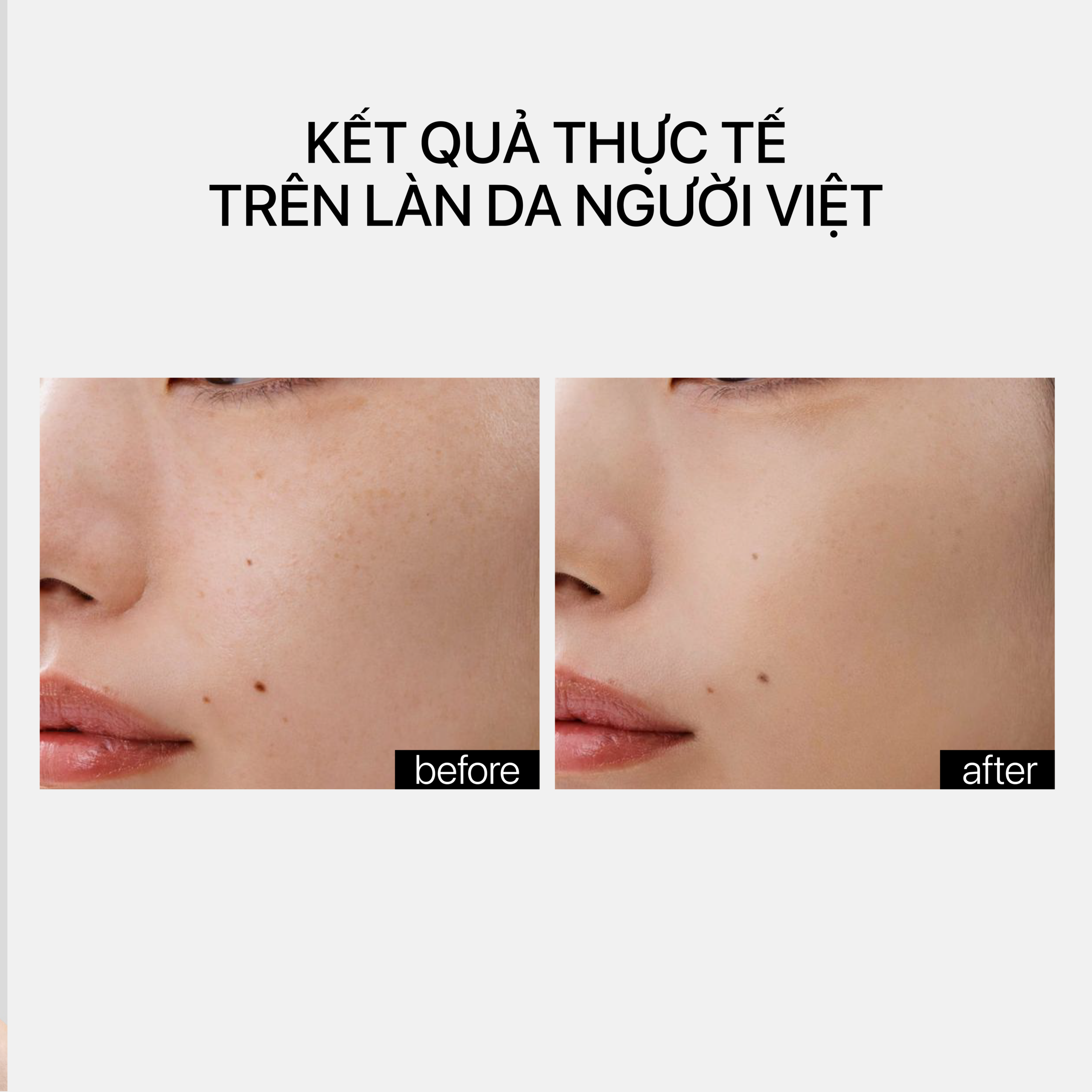 LINO-8 - Ảnh 4