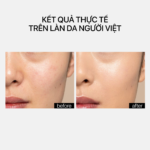 SMOOTHING TREATMENT - Ảnh 4
