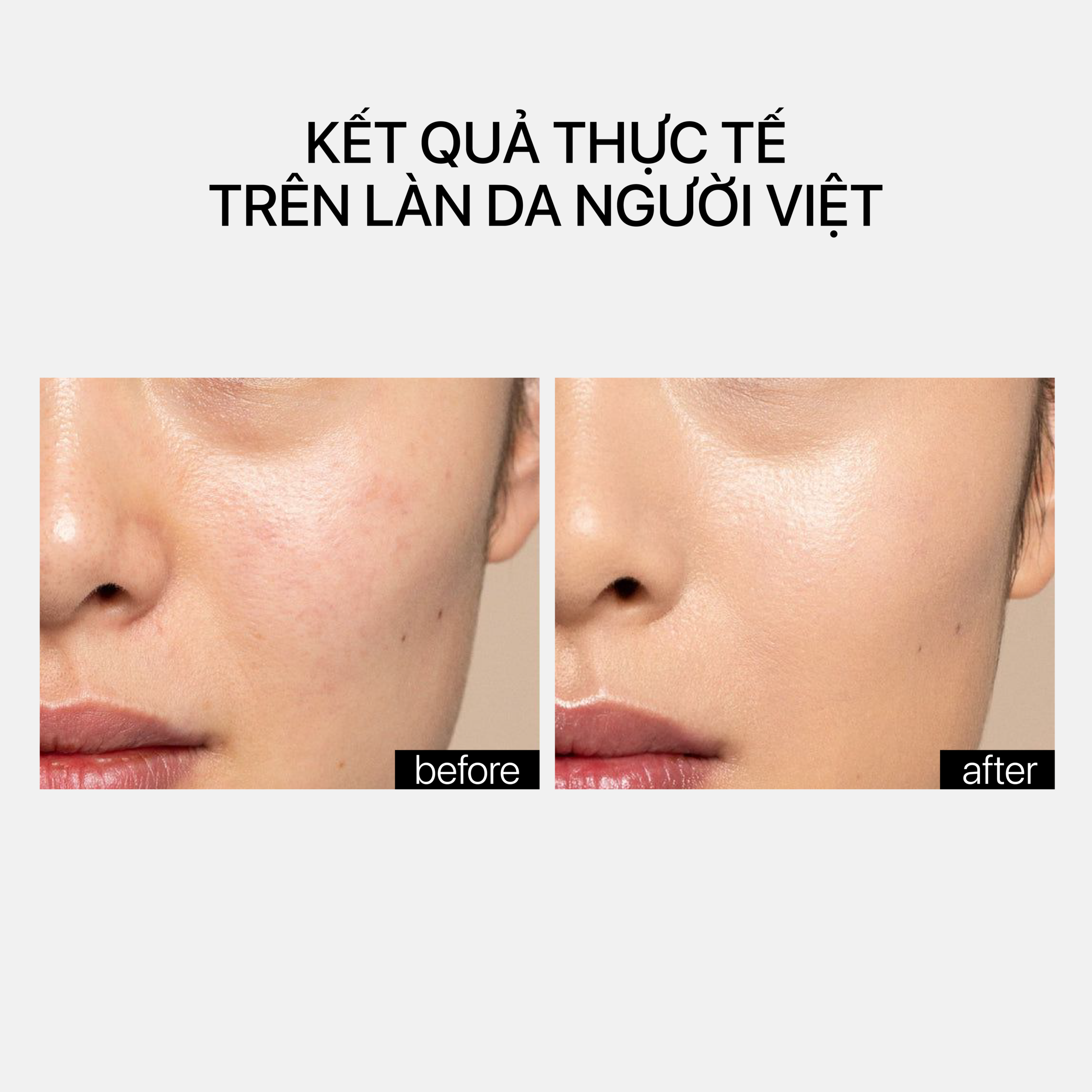 SMOOTHING TREATMENT - Ảnh 4