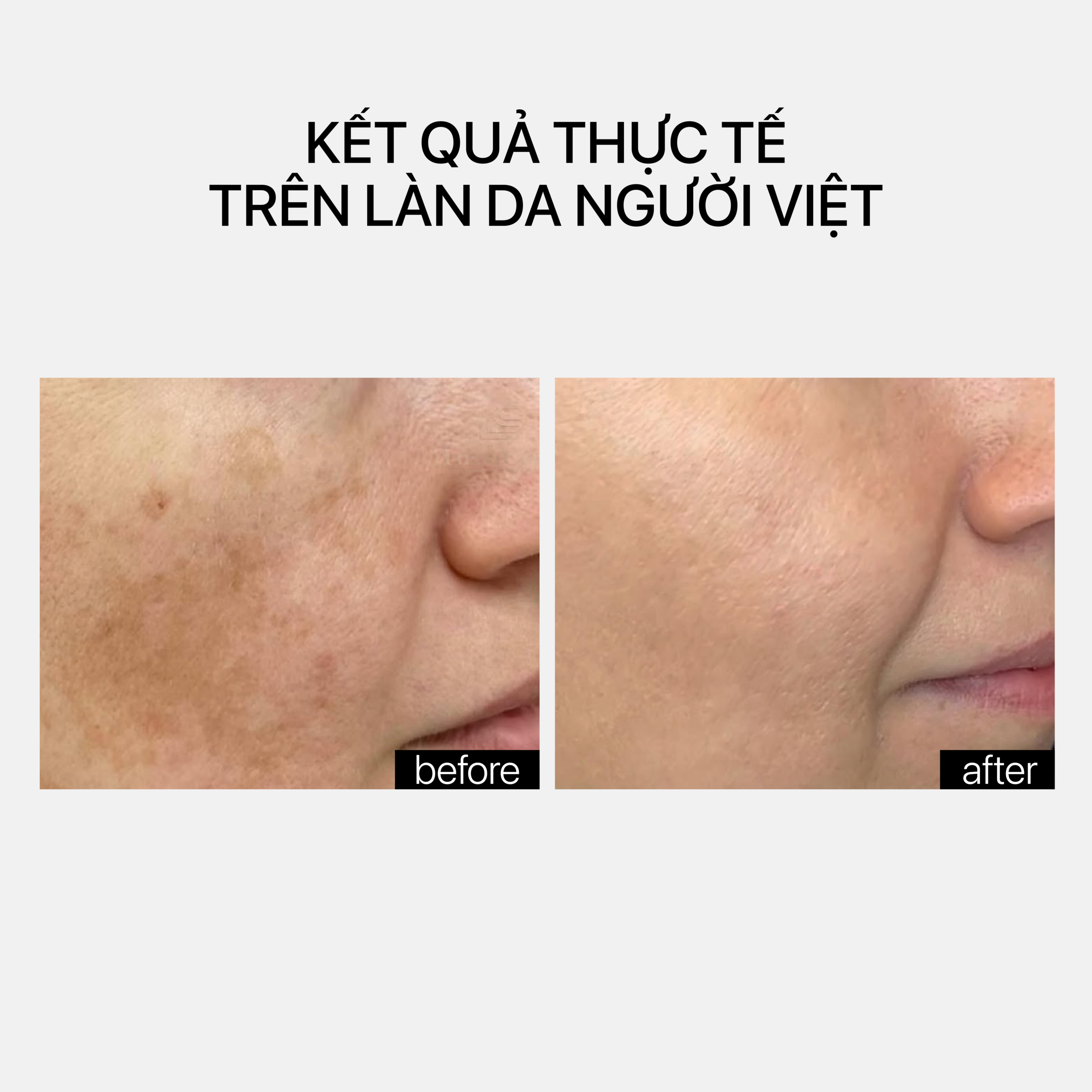TETRAMID C.E.F. - Ảnh 4