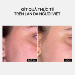 NIACINAMIDE GLOW CREAM (Mini size) 15ml - Ảnh 5