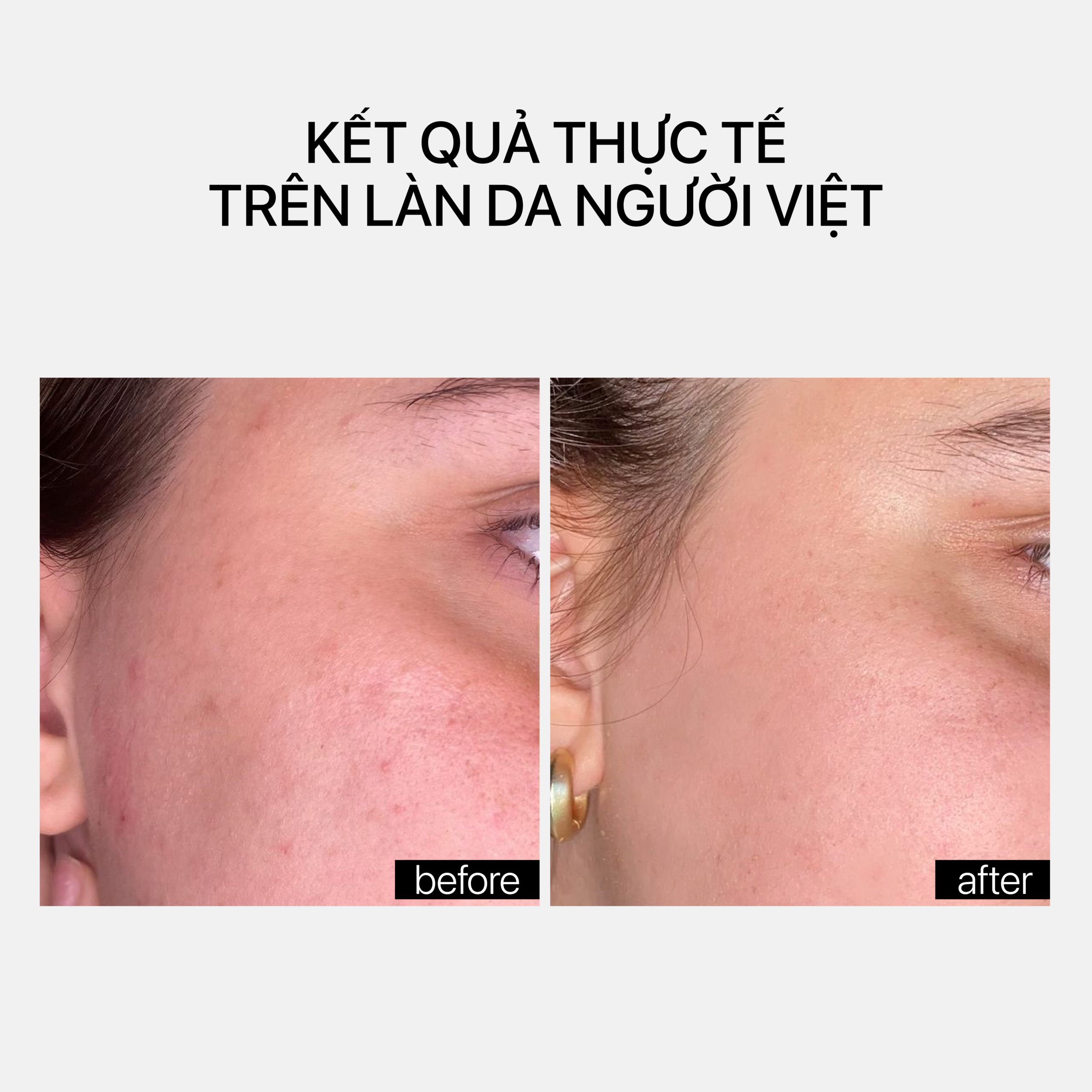 NIACINAMIDE GLOW CREAM (Mini size) 15ml - Ảnh 5