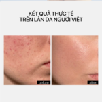 NIACINAMIDE GLOW CREAM - Ảnh 4