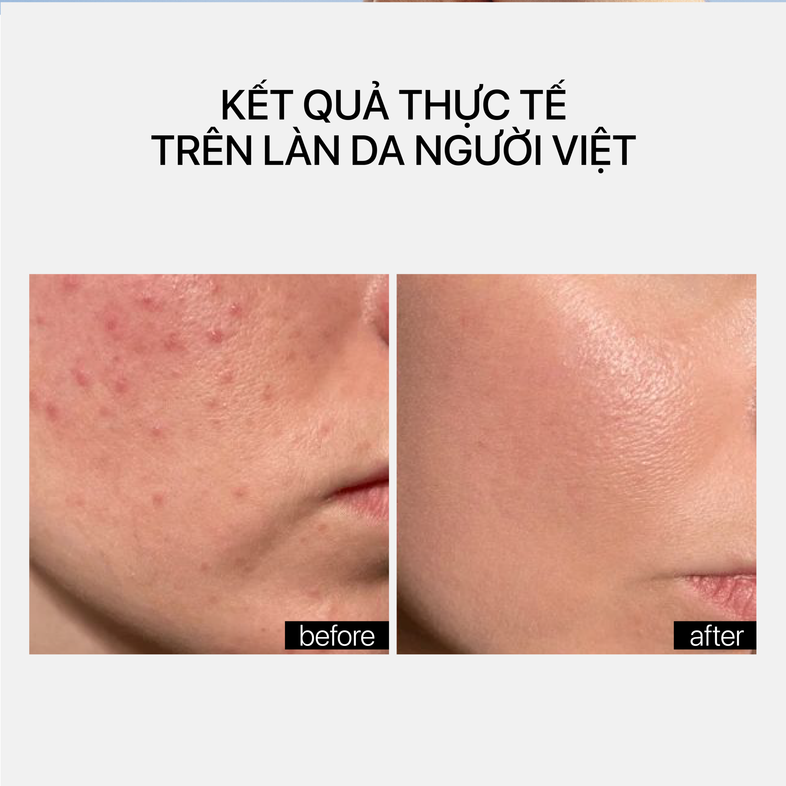 NIACINAMIDE GLOW CREAM - Ảnh 4