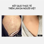 TRANSPARENT LAB AHA SMOOTHING BODY LOTION - Ảnh 2