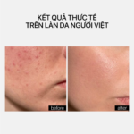 OIL-BASED CLEANSER - Ảnh 4