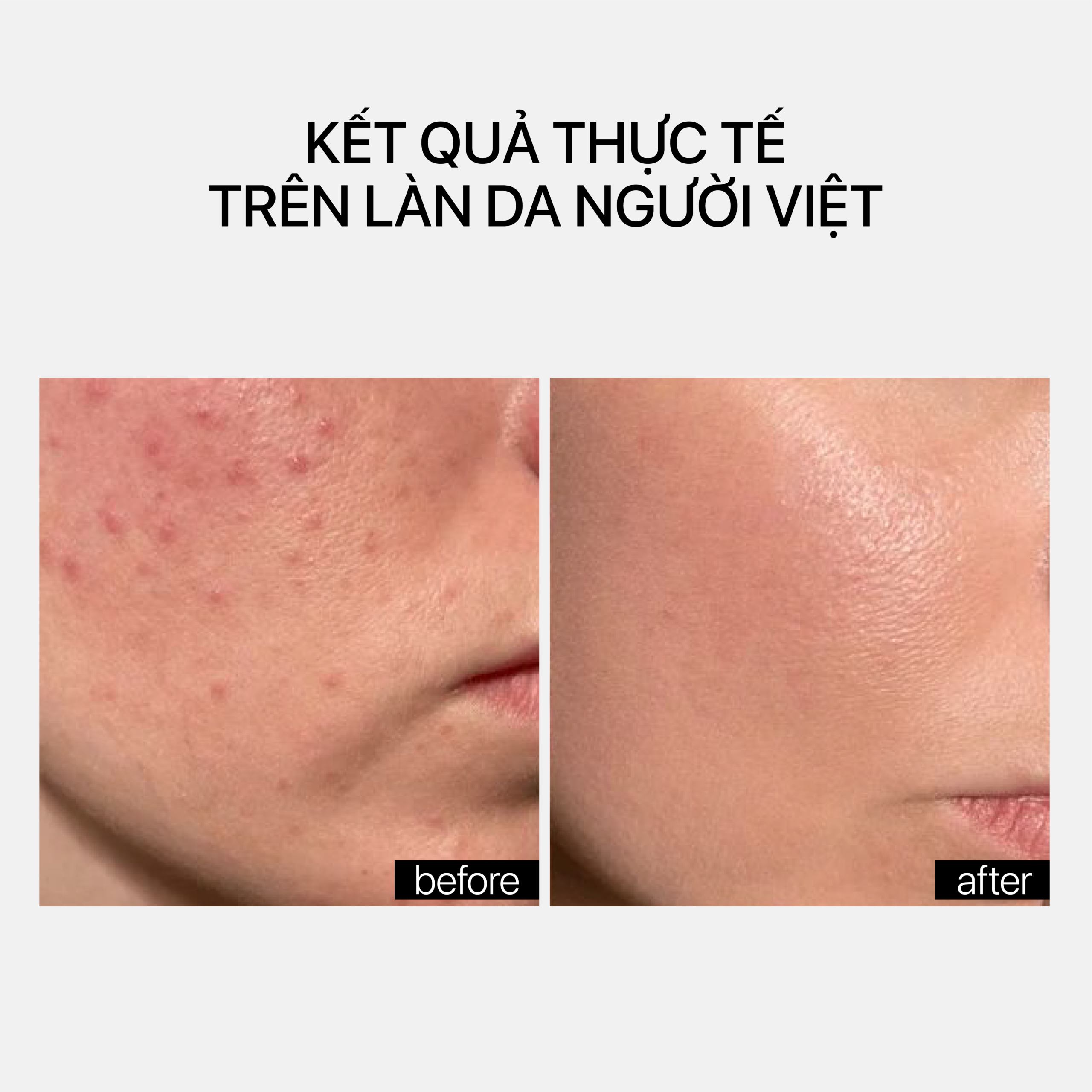OIL PATROL SERUM - Ảnh 3