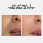 BAKUCHIOL FIRMING CREAM - Ảnh 2