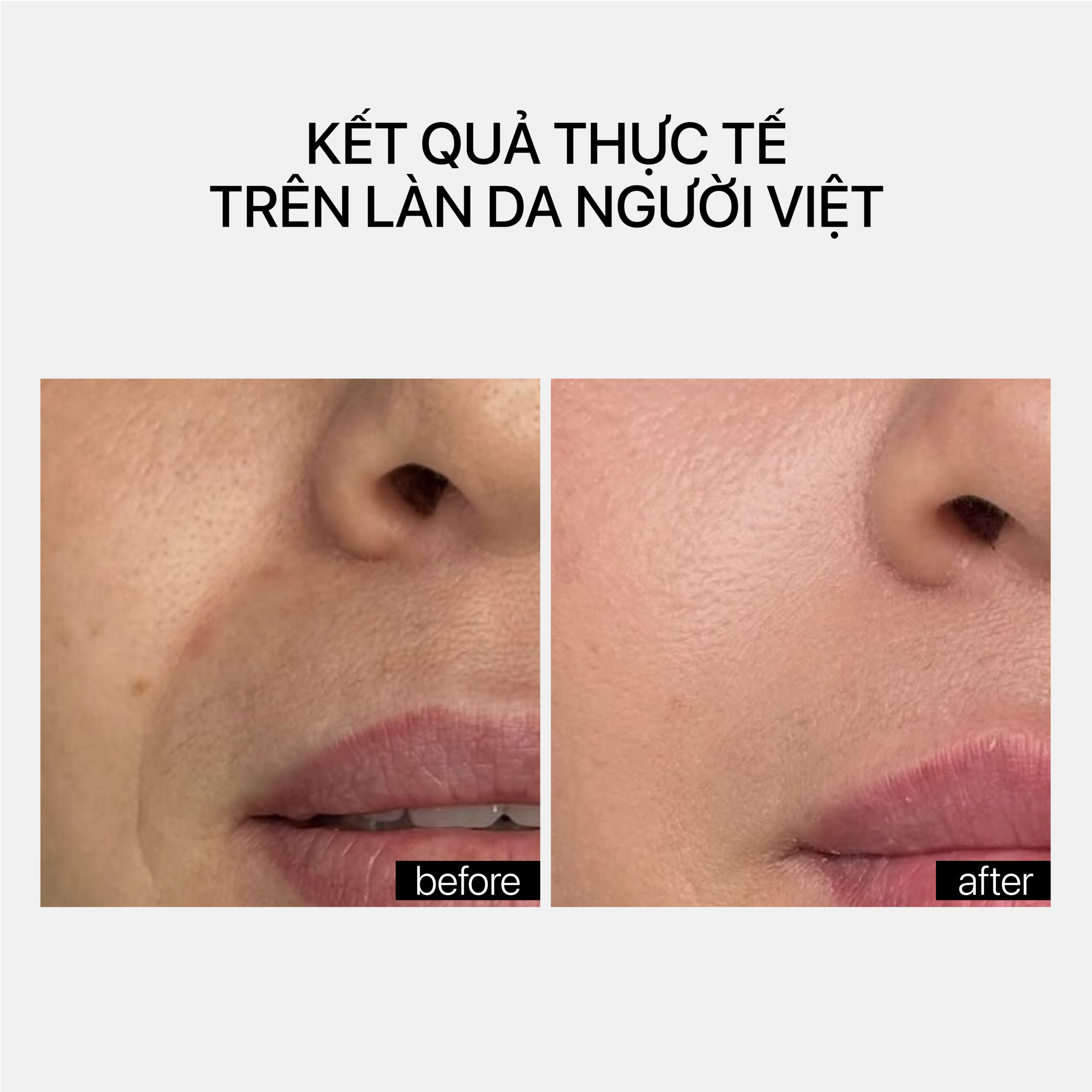 BAKUCHIOL FIRMING CREAM - Ảnh 2