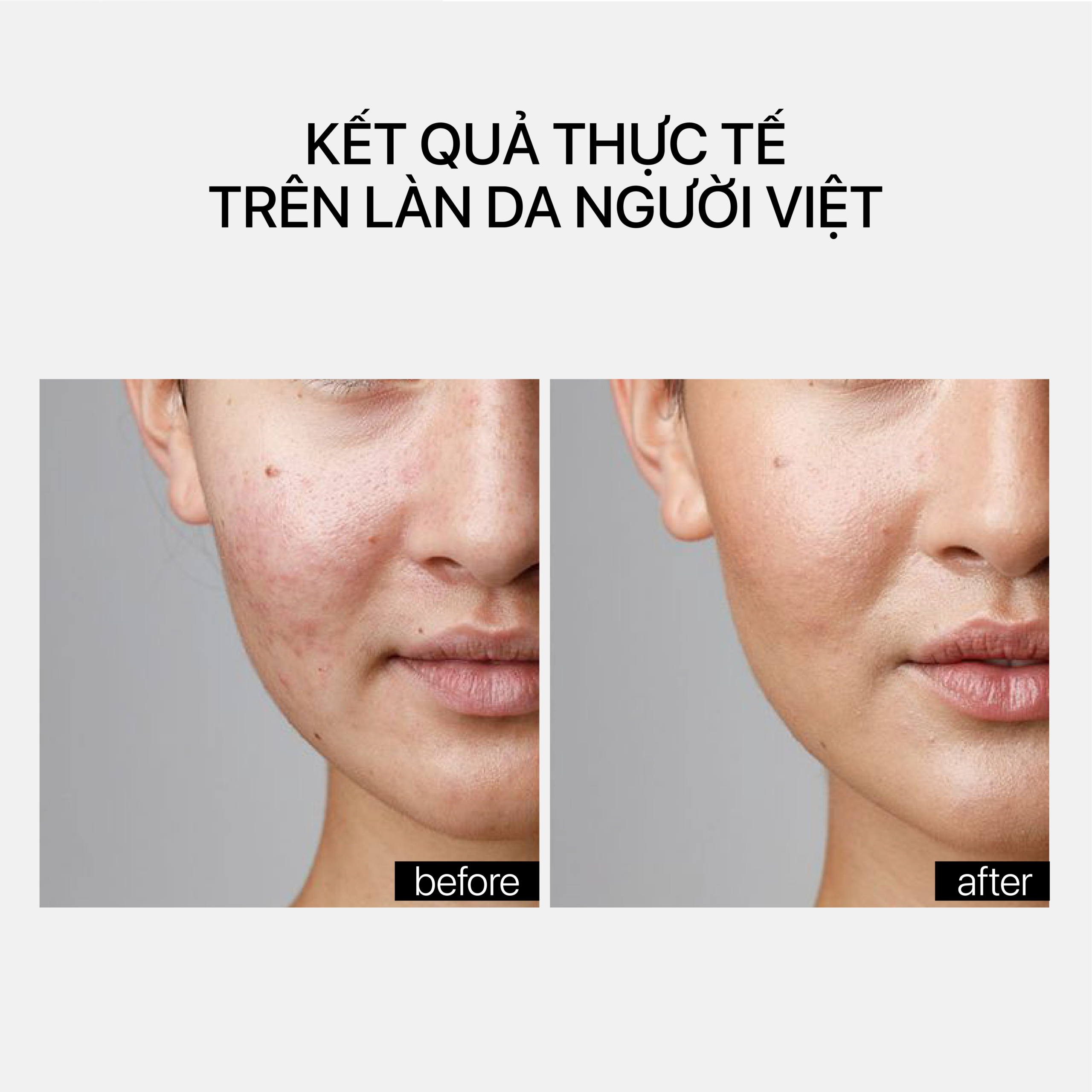 BARRIER RESTORING HYDRATING CREAM - Ảnh 6