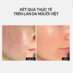 CERAMIDE REPAIR MOISTURIZER (Mini Size) 10ml - Ảnh 4