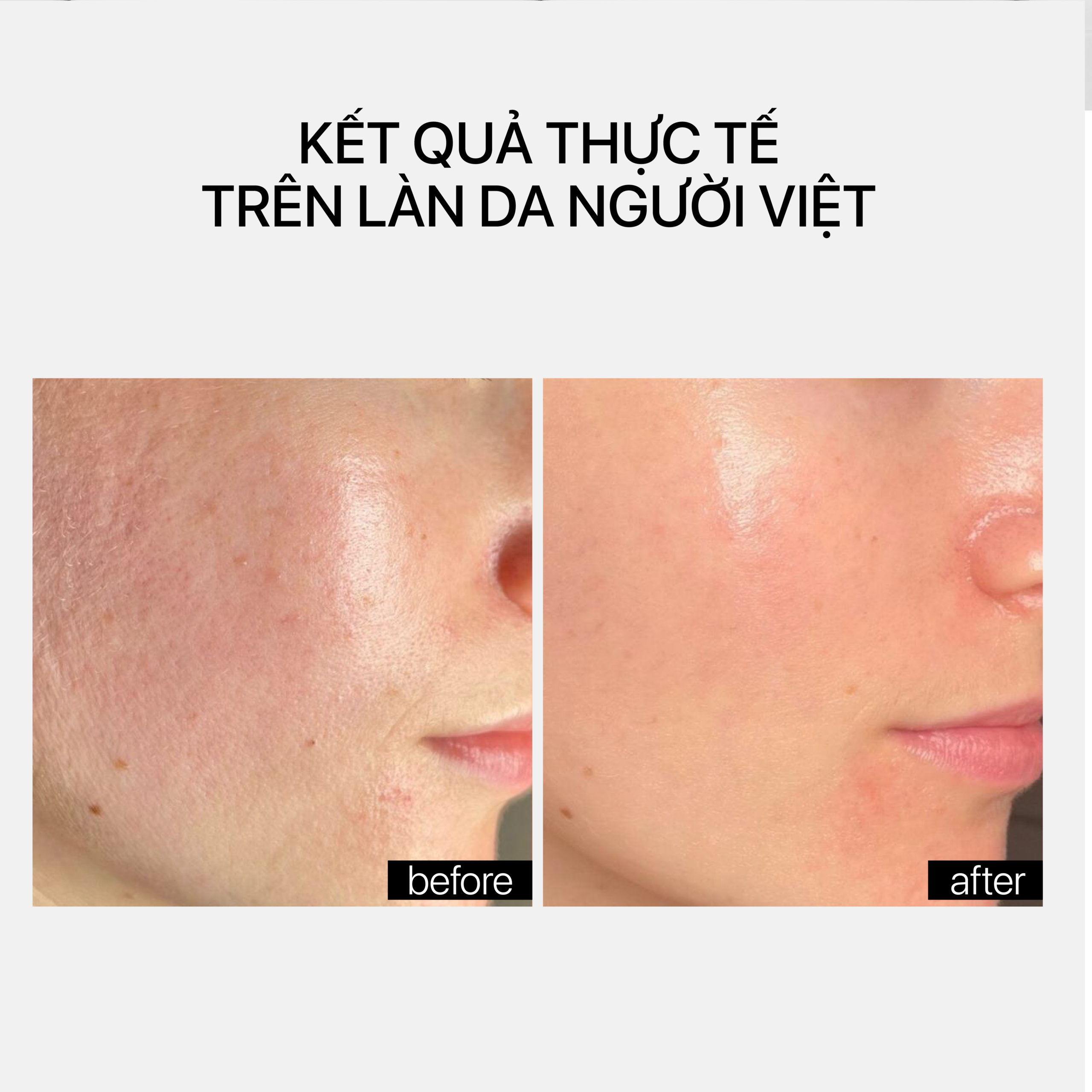 CERAMIDE REPAIR MOISTURIZER (Mini Size) 10ml - Ảnh 4