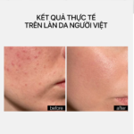 CERAMIDE REPAIR MOISTURIZER - Ảnh 5