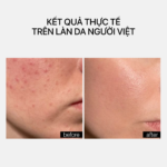 DE-BLOAT SOOTHING EYE SERUM - Ảnh 5