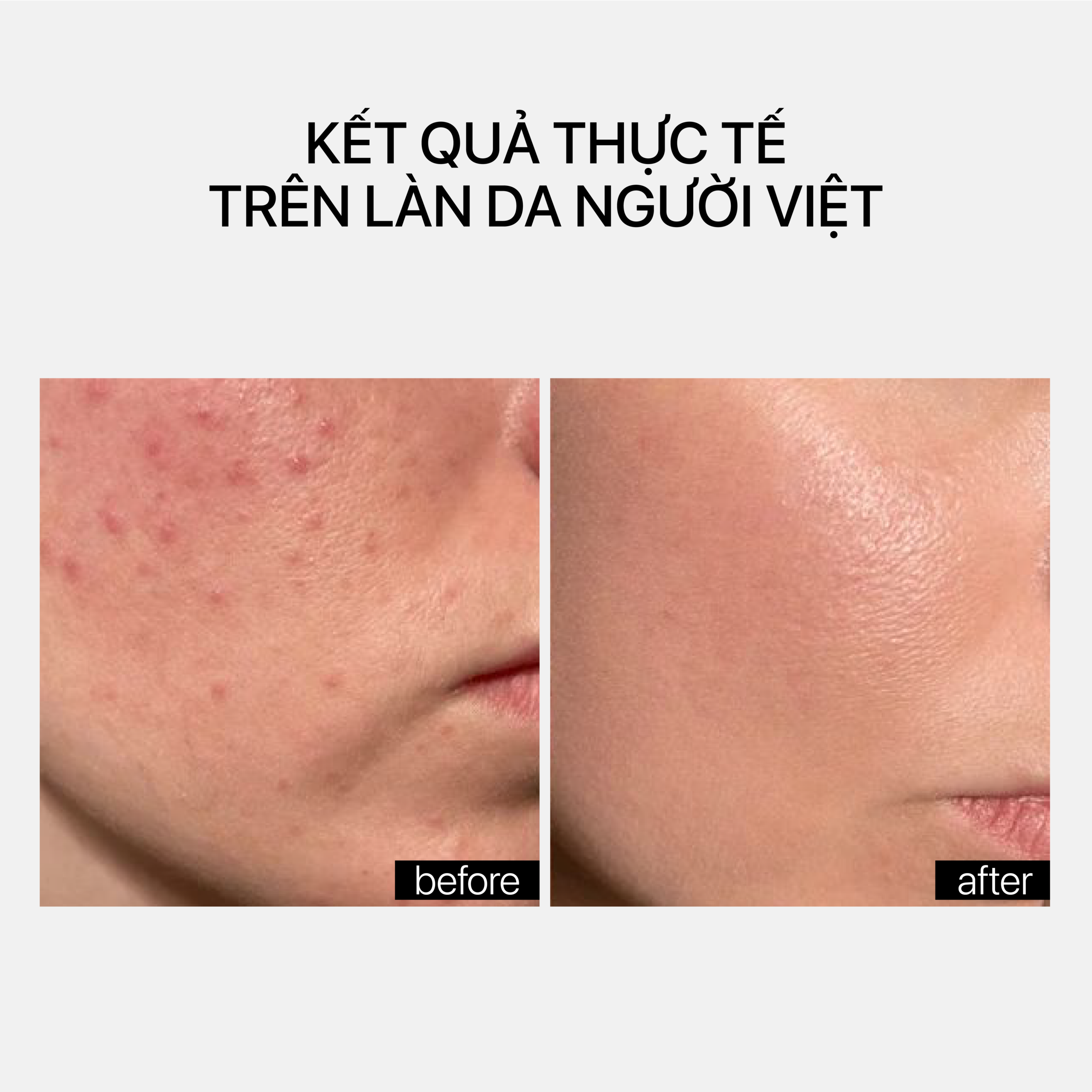 DE-BLOAT SOOTHING EYE SERUM - Ảnh 5