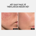 EYE REPAIR COMPLEX - Ảnh 6