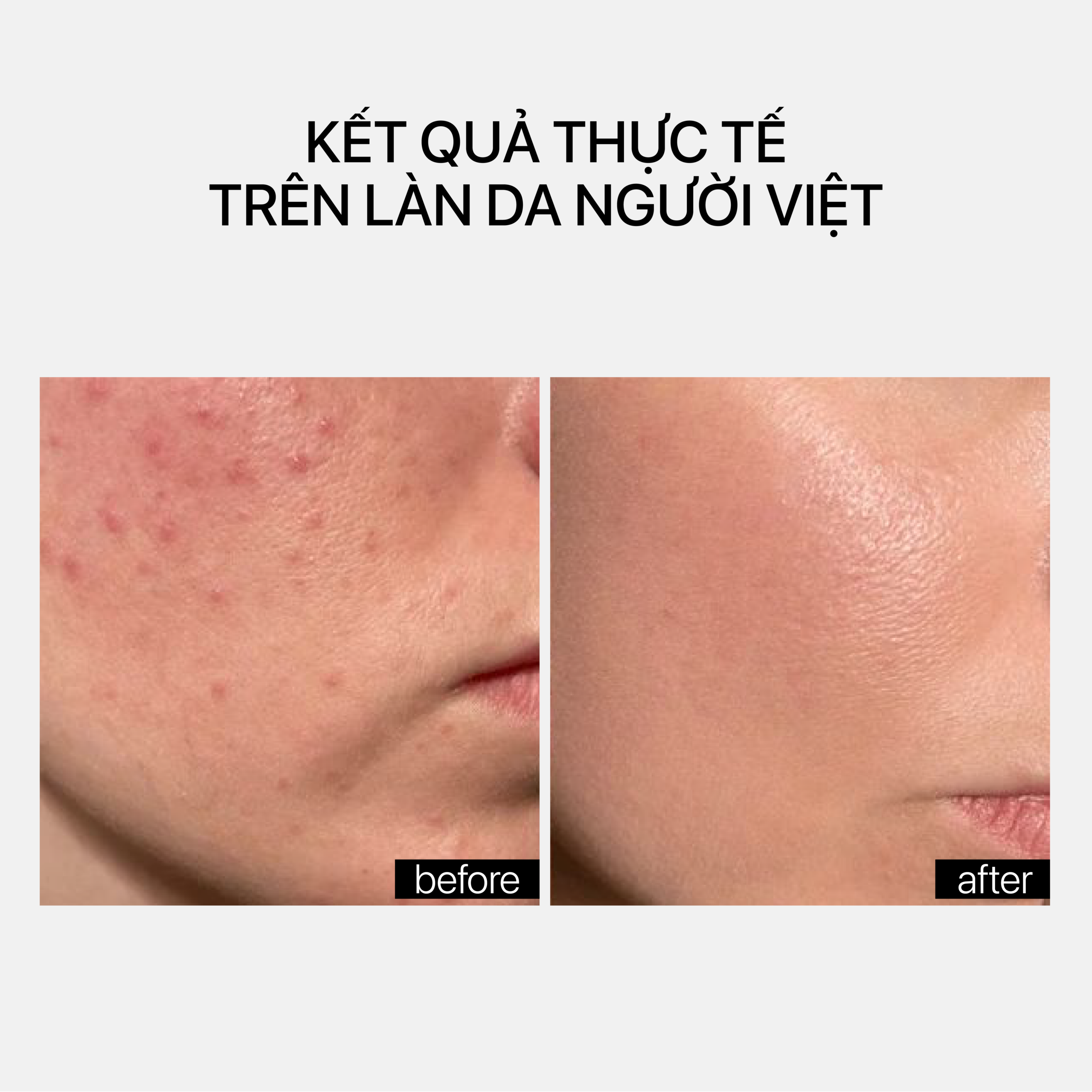 EYE REPAIR COMPLEX - Ảnh 6