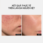 EYELASH GROWTH - Ảnh 5