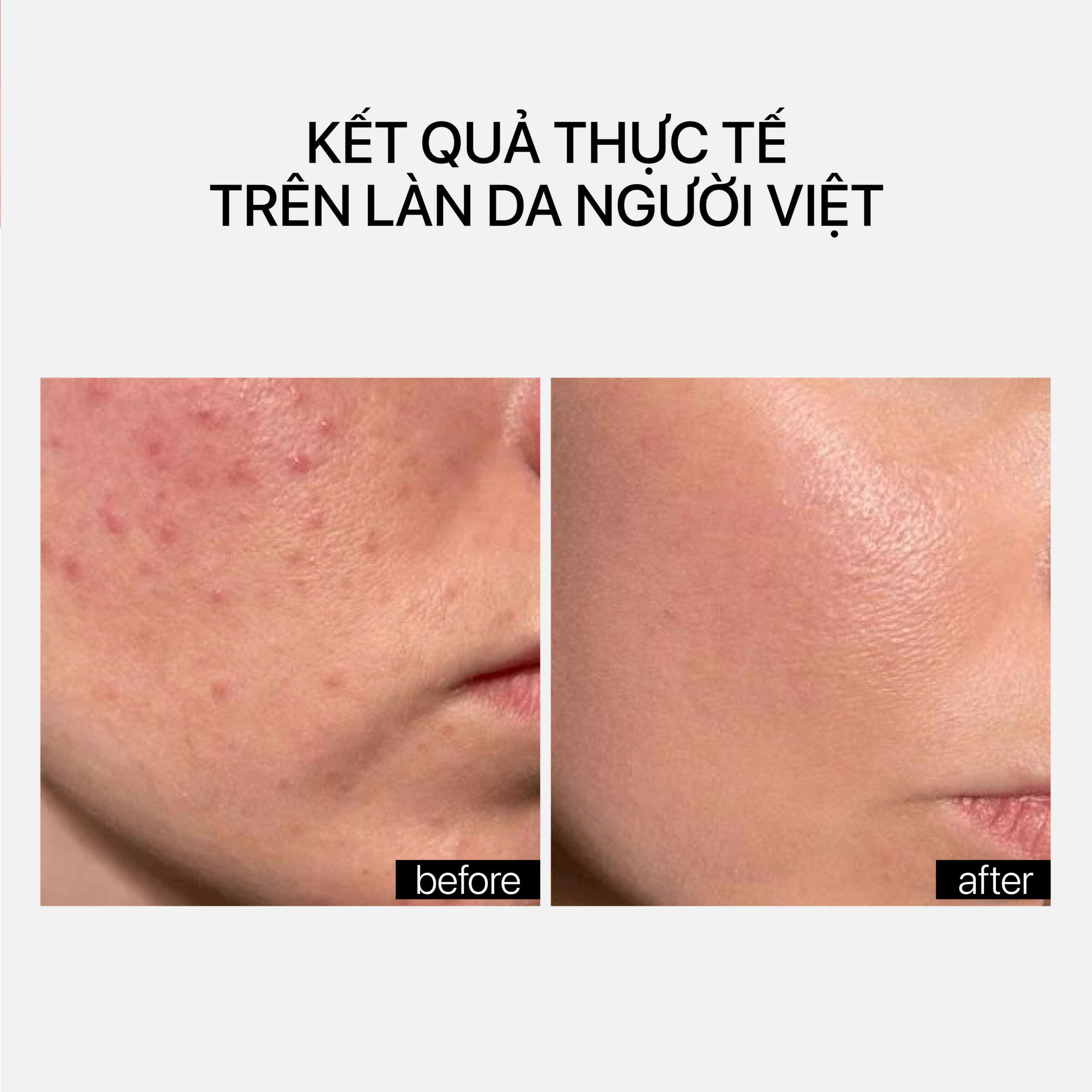 EYELASH GROWTH - Ảnh 5