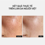GENTLE REJUVENATION SERUM - Ảnh 4