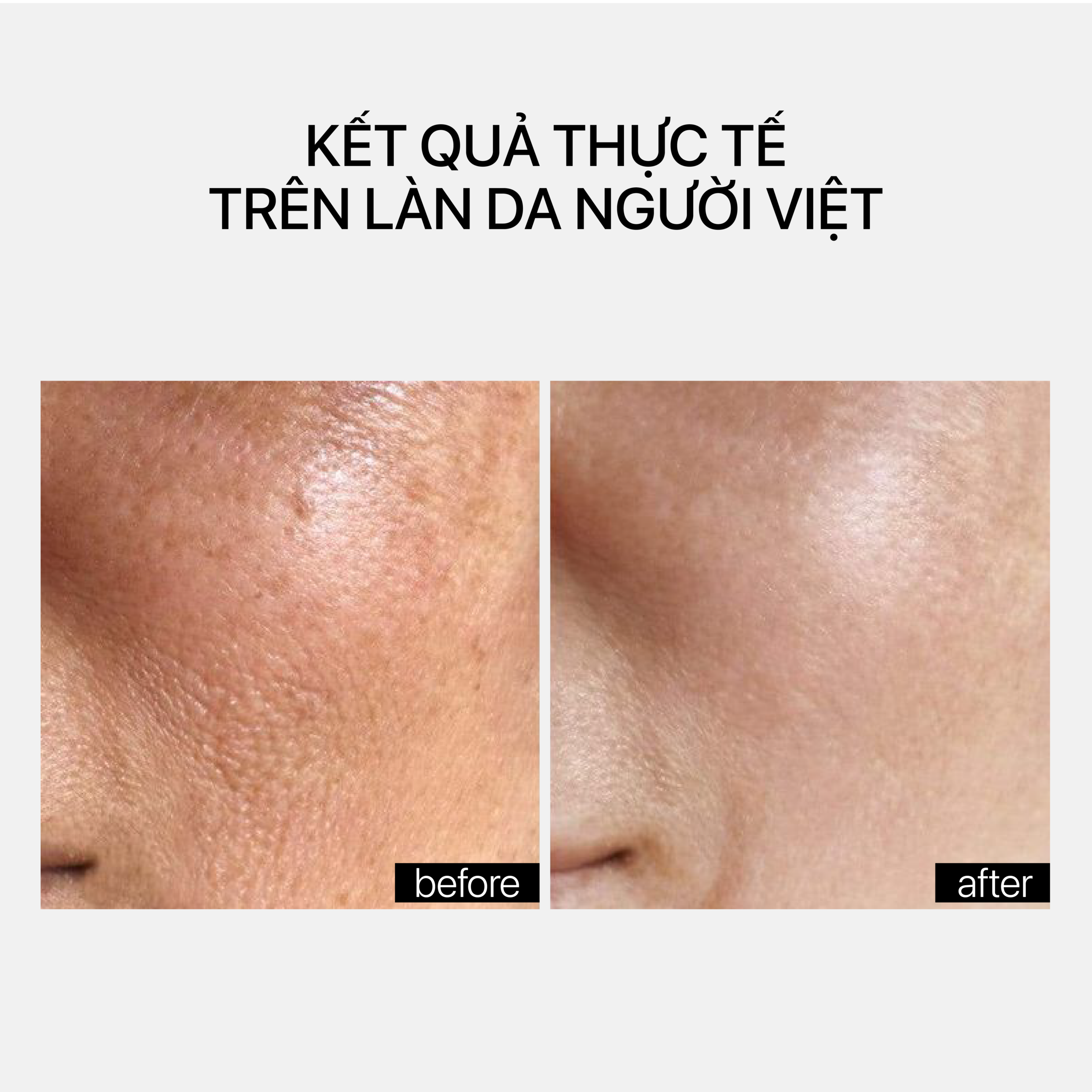 GENTLE REJUVENATION SERUM - Ảnh 4