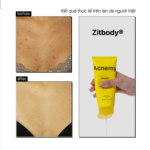 ZITBODY® POST BREAKOUT TREATMENT - Ảnh 5