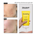 ZITCALM® ANTI REDNESS CALMING CLEANSER - Ảnh 6