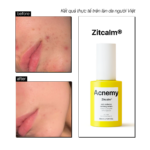 ZITCALM SERUM Huyết thanh giảm đỏ và làm dịu da - Ảnh 3