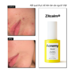 ZITCALM SERUM - Ảnh 5