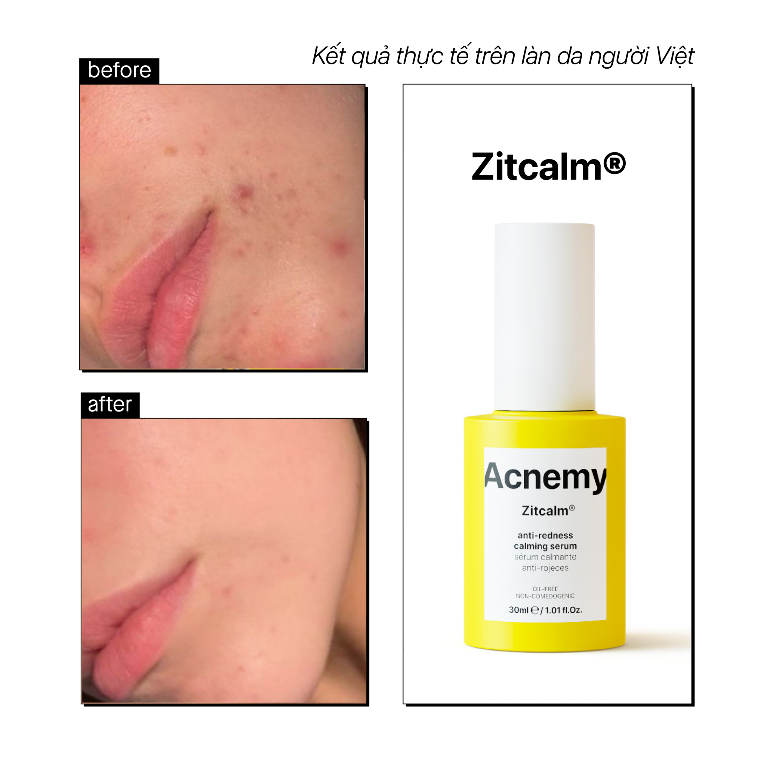 ZITCALM SERUM - Ảnh 5