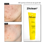 ZITCLEAN® PURIFYING CLEANSING GEL (Mini zise) 60ml - Ảnh 7