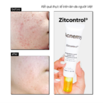 ZITCONTROL® BLEMISH CONTROL MOISTURIZER - Ảnh 4