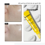 ZITCONTROL® SPF50 - Ảnh 4