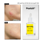 POSTZIT® - Ảnh 3