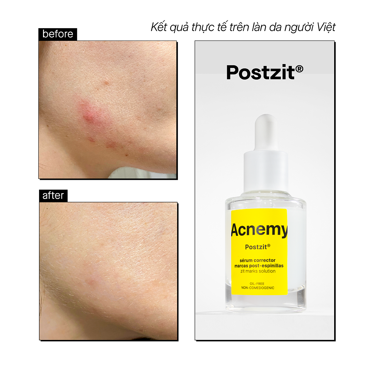 POSTZIT® - Ảnh 3