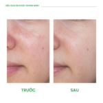 CICA - SKIN RESCUE GREEN CREAM Kem dưỡng làm dịu & phục hồi chuyên sâu - Ảnh 7